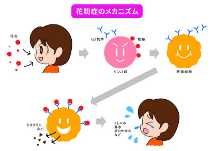 花粉症のメカニズム