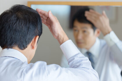 薄毛外来
